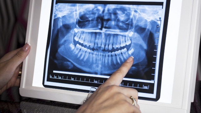 Dentist pointing to digital dental x rays