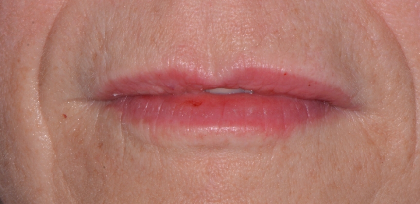  teeth before dental treatment
