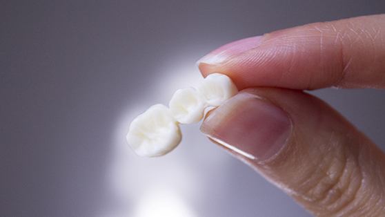 Thumb and forefinger holding three-unit dental bridge