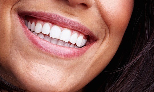 Close up of smile with straight white teeth thanks to cosmetic dentist in Colchester
