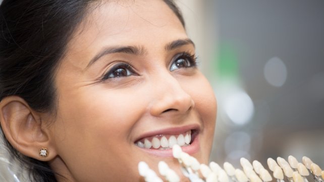 Woman's smile compared with porcelain veneer color chart