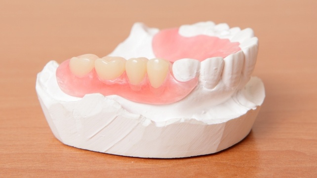 Model of row of teeth with some replaced by partial denture in Colchester