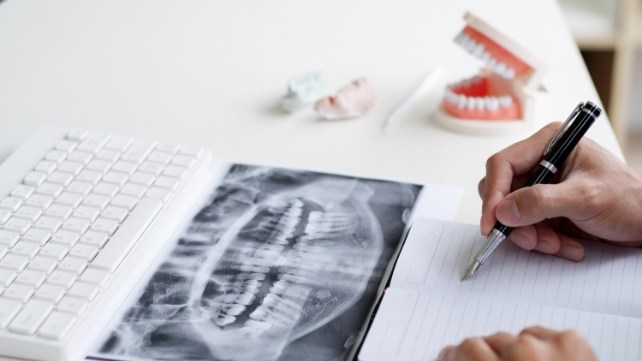 Person writing on notepad next to keyword and model of teeth