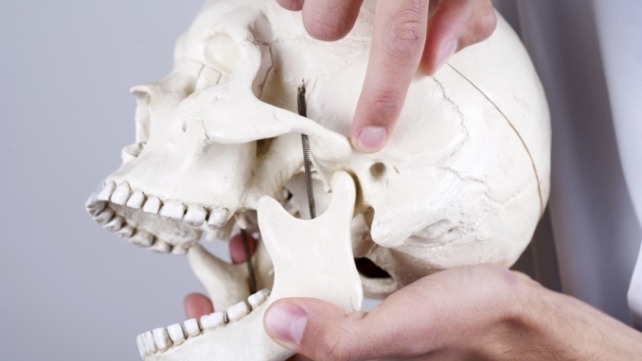 Model of jaw and skull bone used to demonstrate need for T M J therapy