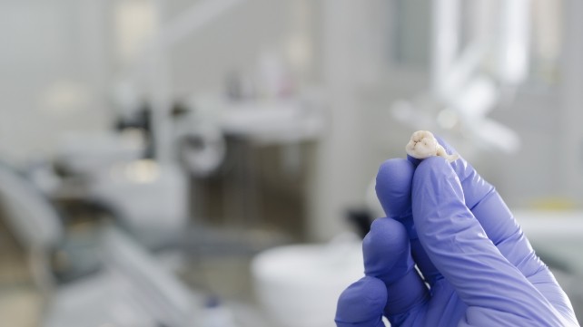 Gloved hand holding an extracted tooth