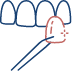 Animated dental veneer being placed on a tooth