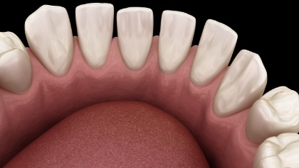 Smile with larger gaps between teeth