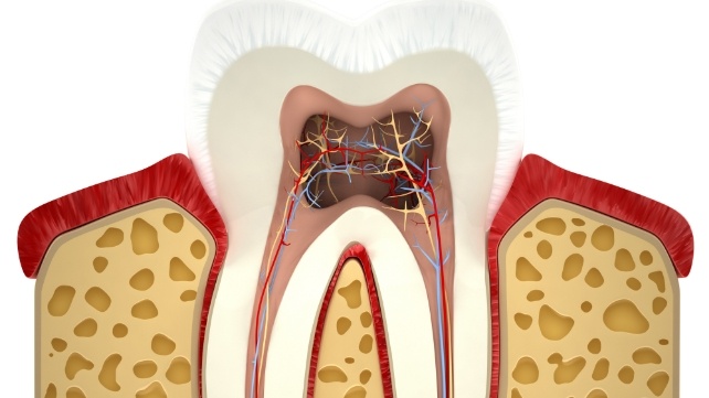 Animated inside of a tooth before root canal therapy
