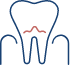 Animated tooth with receding gums representing need for periodontal therapy