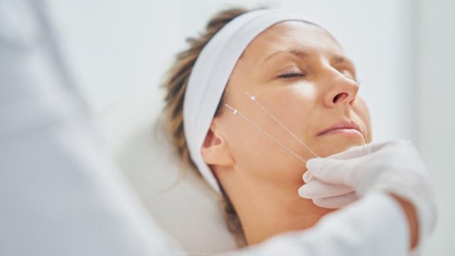 Dental patient preparing to undergo the process of P D O lifting threads in Colchester